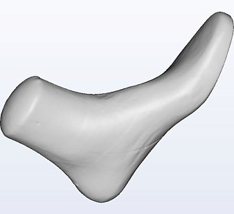 Ортопедический 3D сканер ScanPod3D XPOD-HD